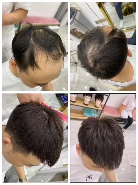 男士补发