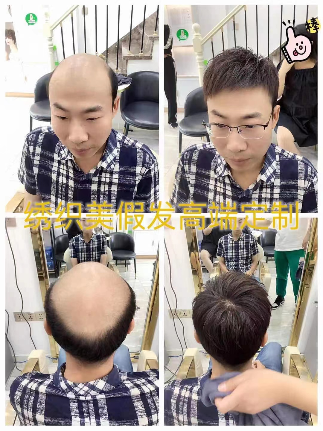 男士补发