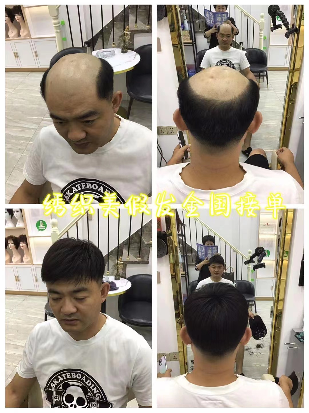 男士补发