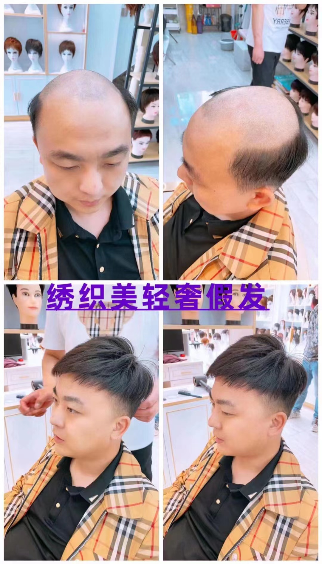 男士补发