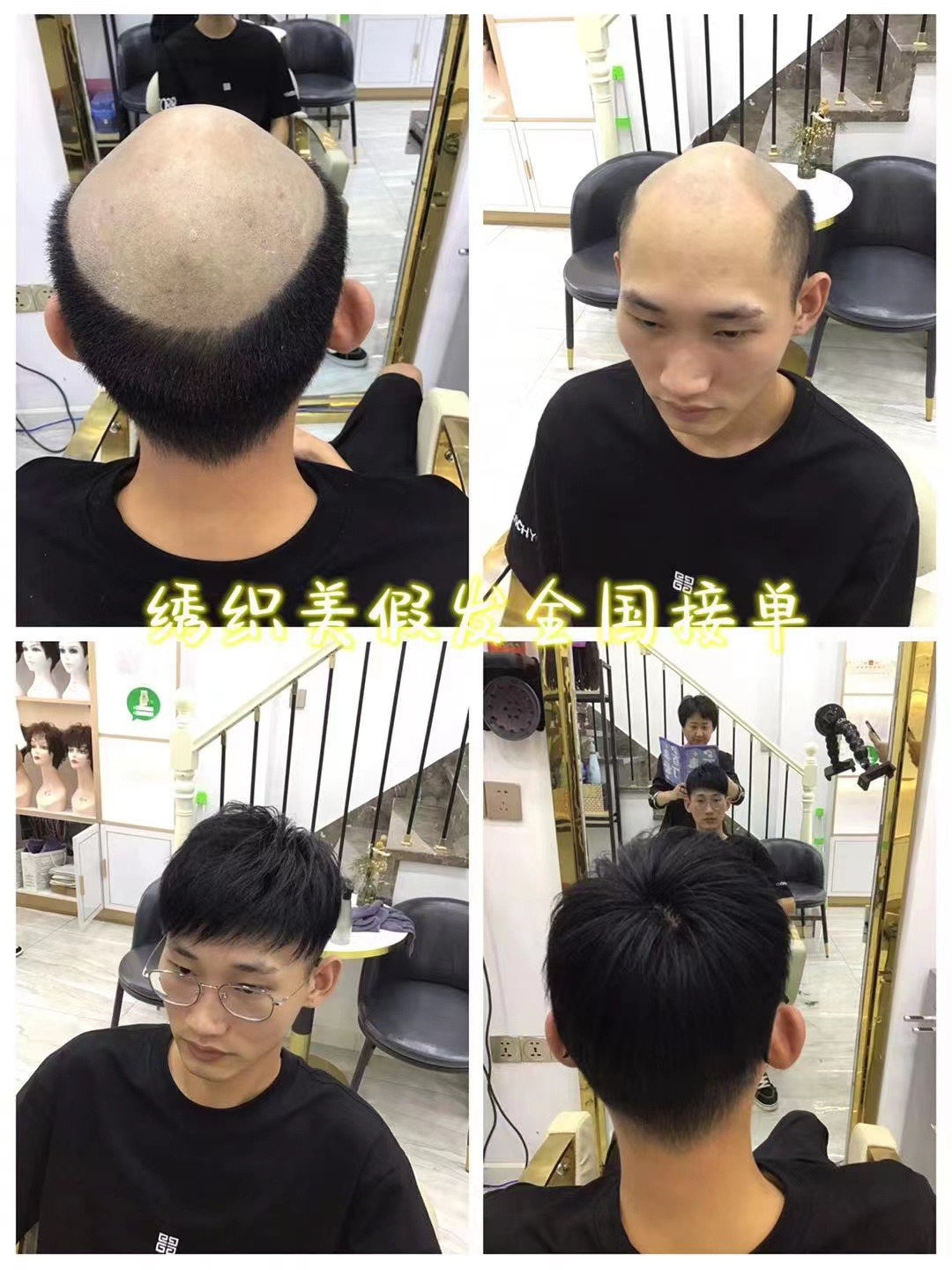 男士补发
