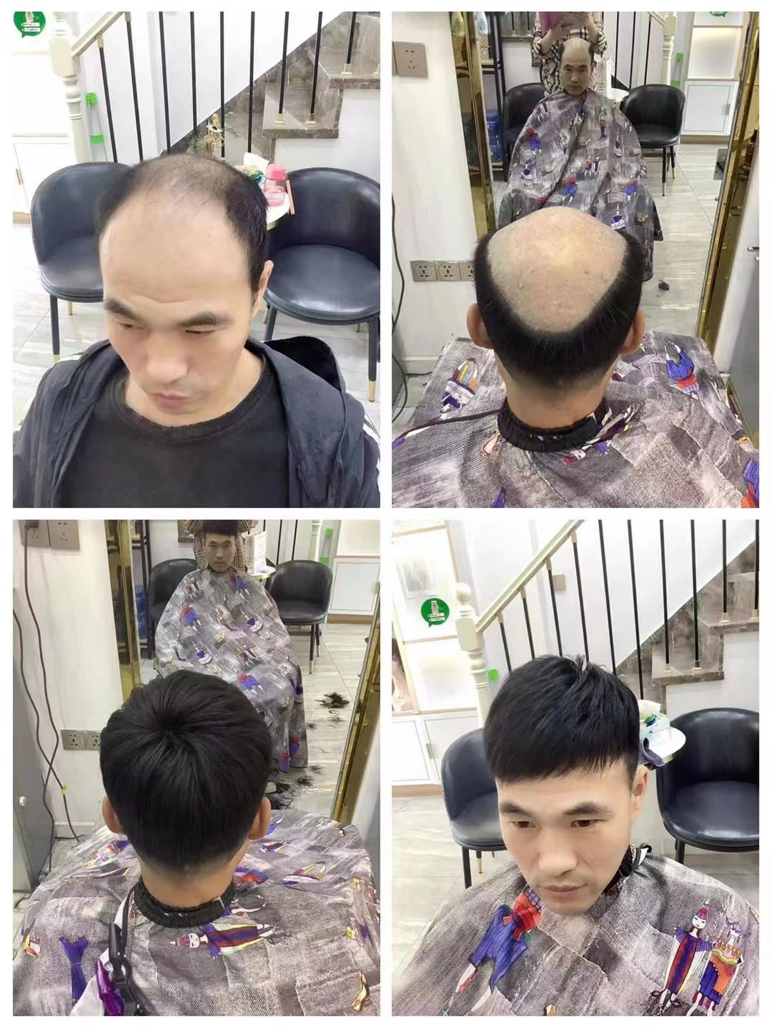 男士补发